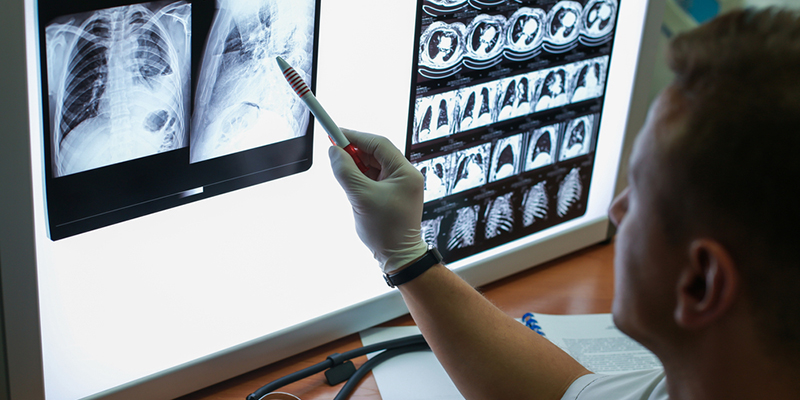 Radiographer examining X-rays