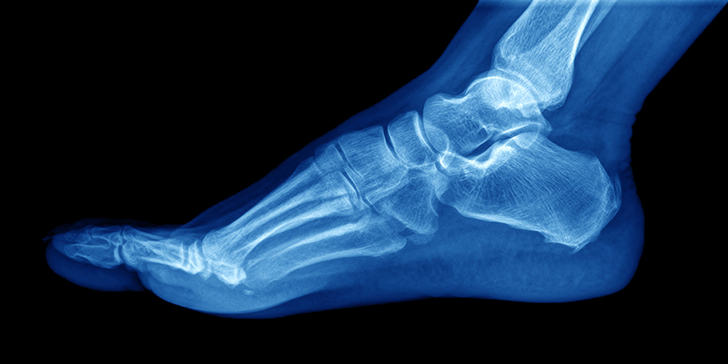 Pop-up podiatry schools put a spring in the step of healthcare courses ...